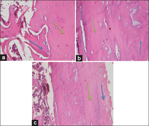 Figure-5