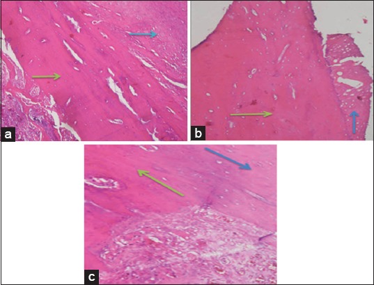 Figure-3