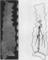 92