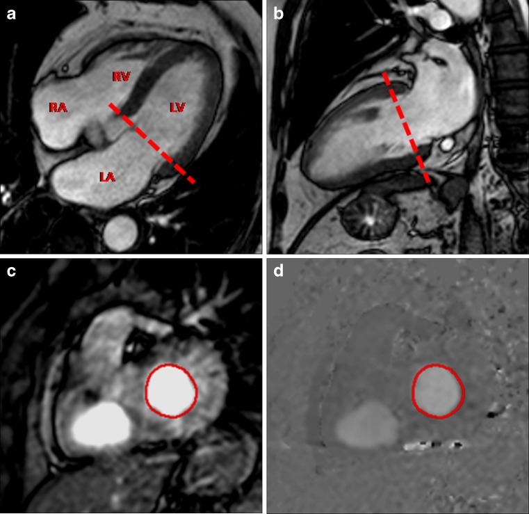 Fig. 1