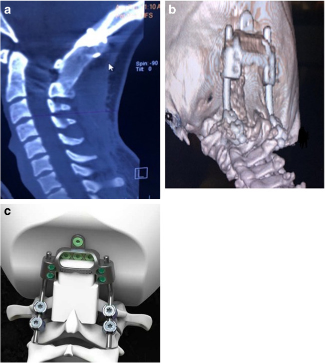 Fig. 3