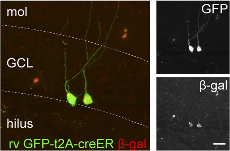 Figure 3—figure supplement 1.