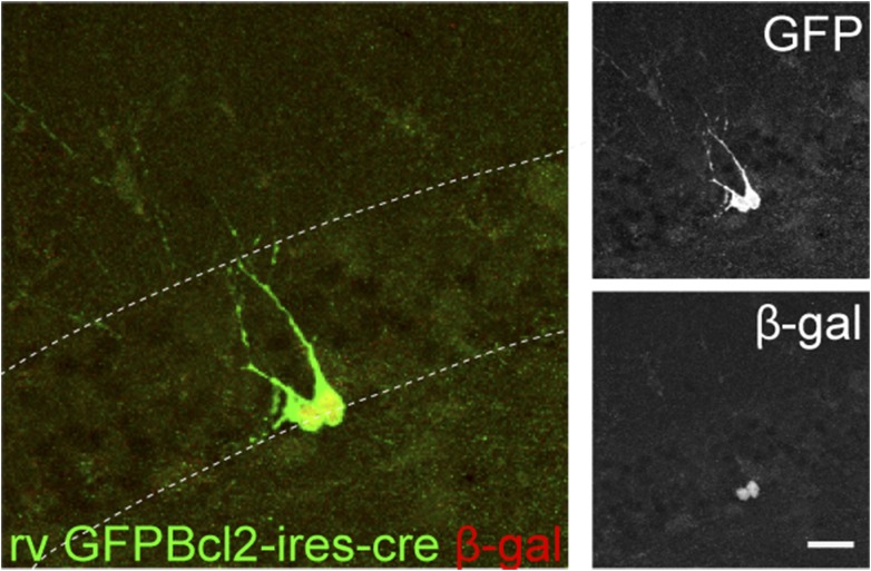 Figure 5—figure supplement 1.