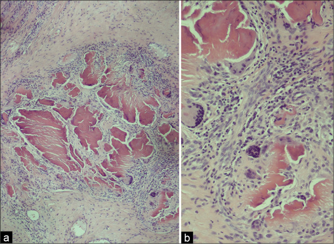 Figure 4: