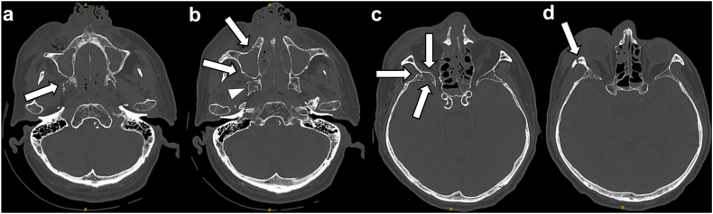 Fig. 2