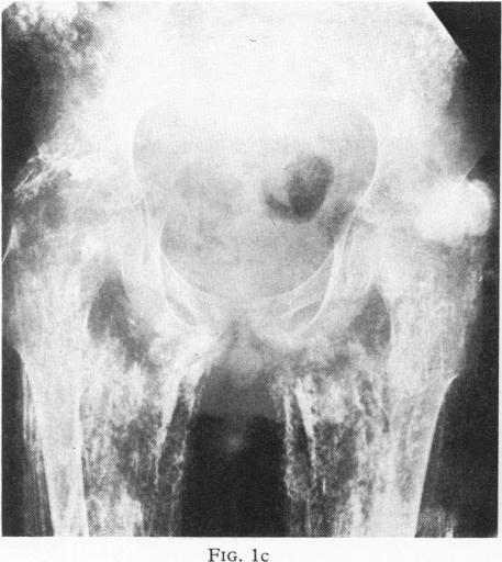 Fig. 1c