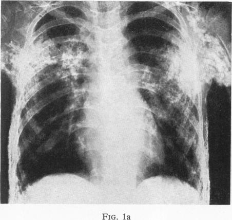 Fig. 1a