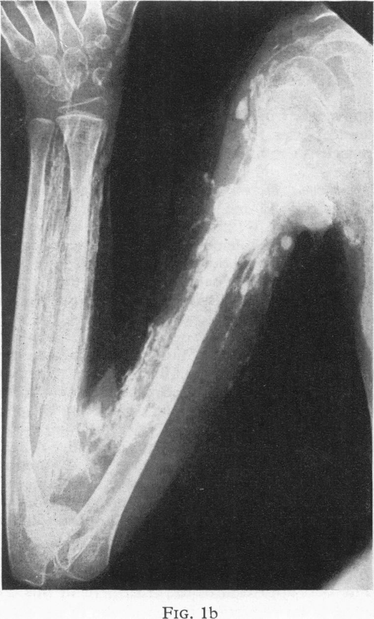 Fig. 1b