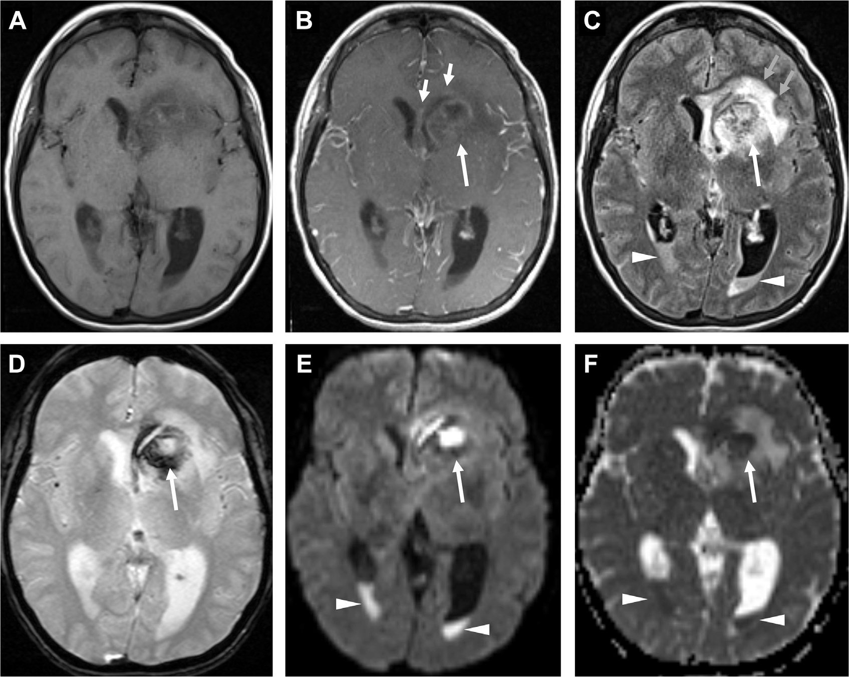 Fig. 20.