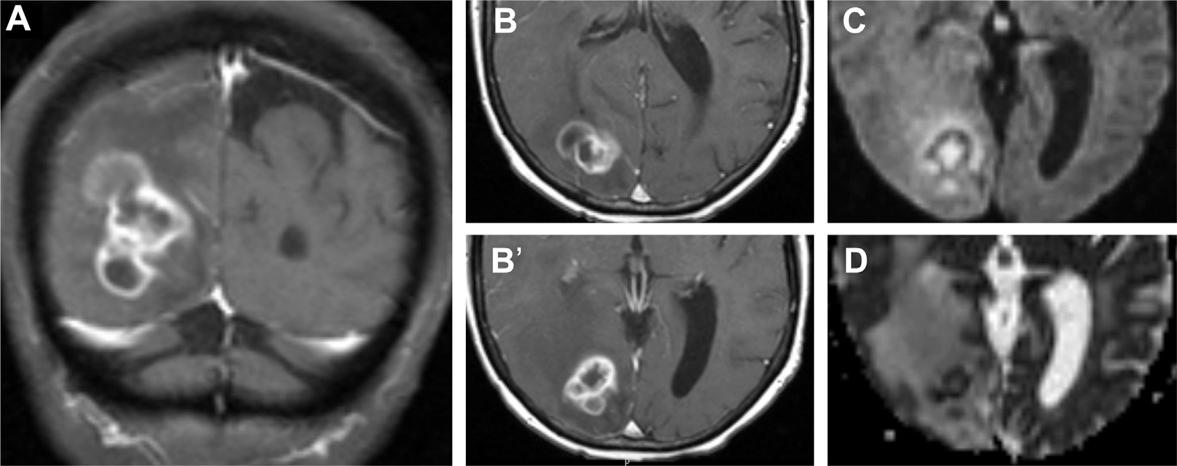 Fig. 15.