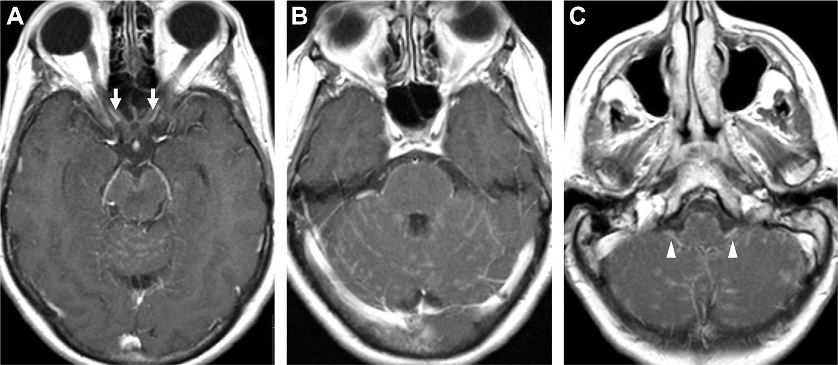 Fig. 28.