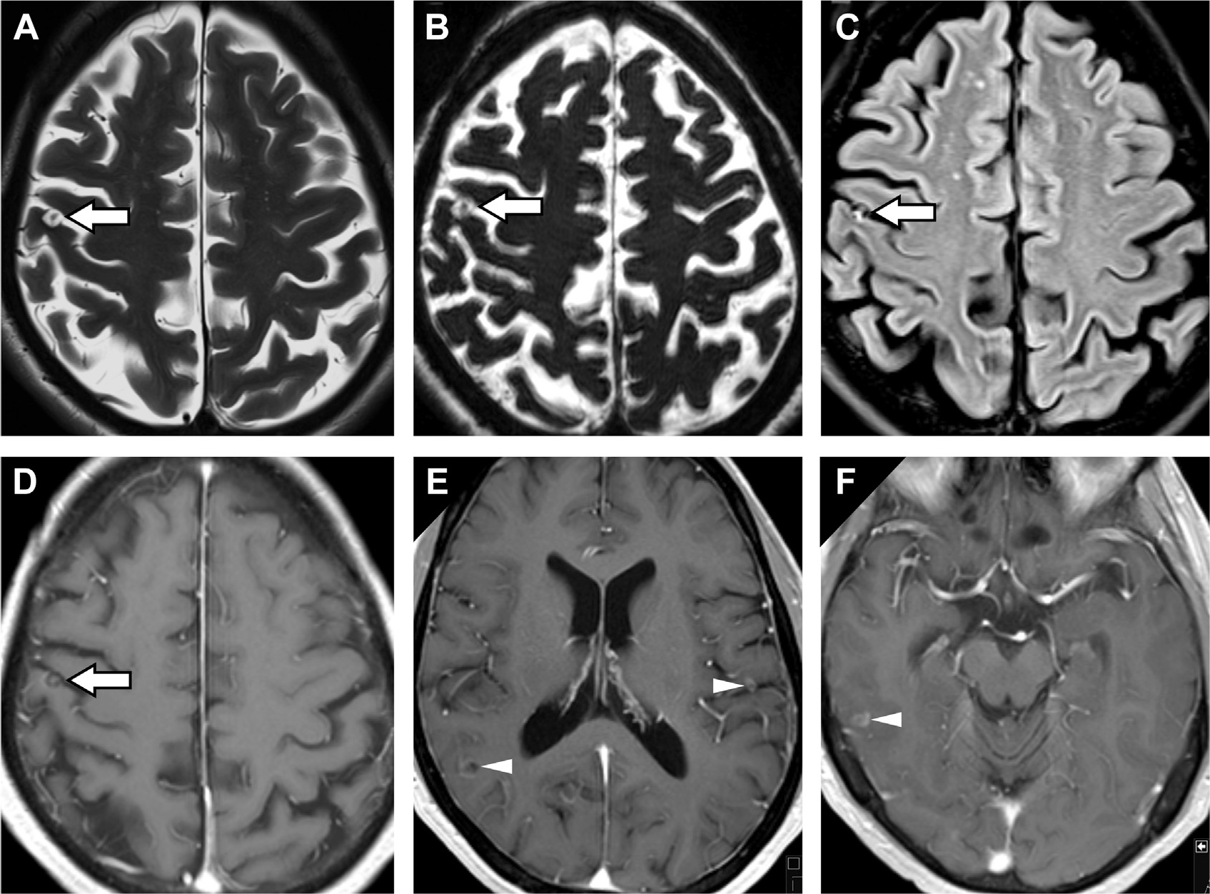 Fig. 19.