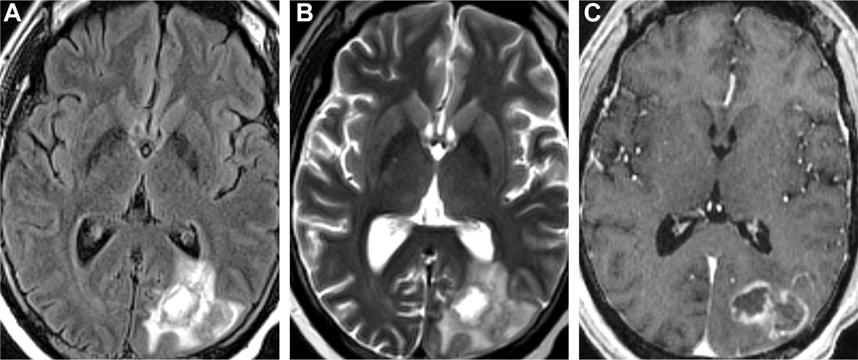 Fig. 14.