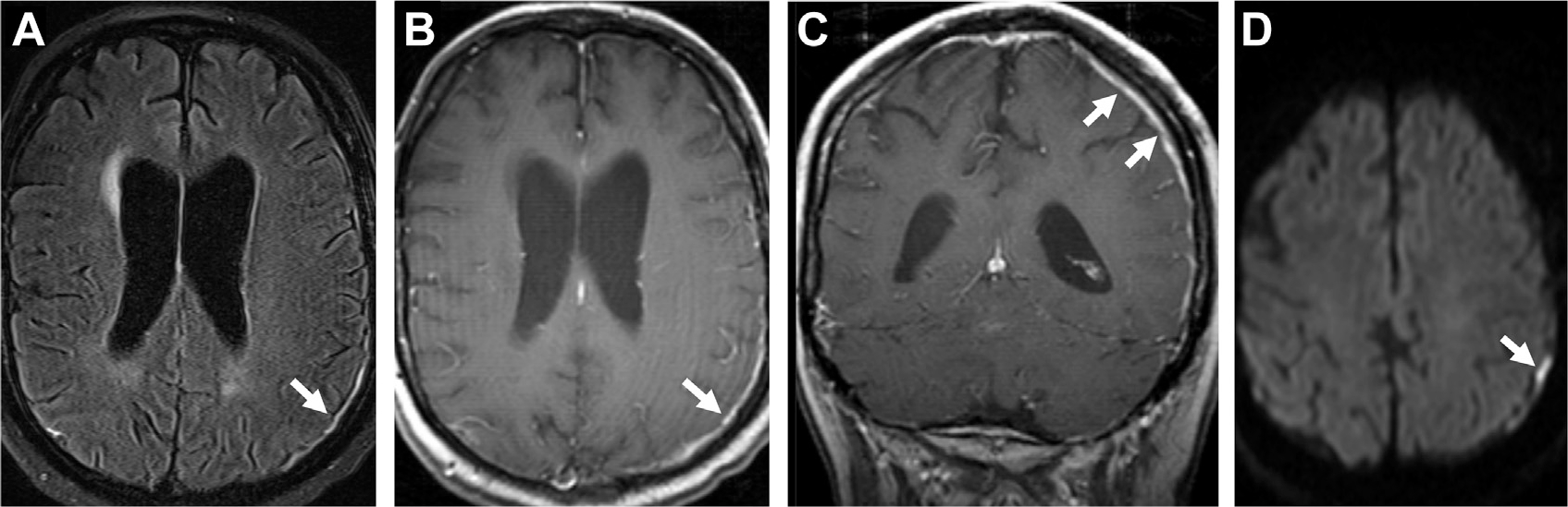 Fig. 27.