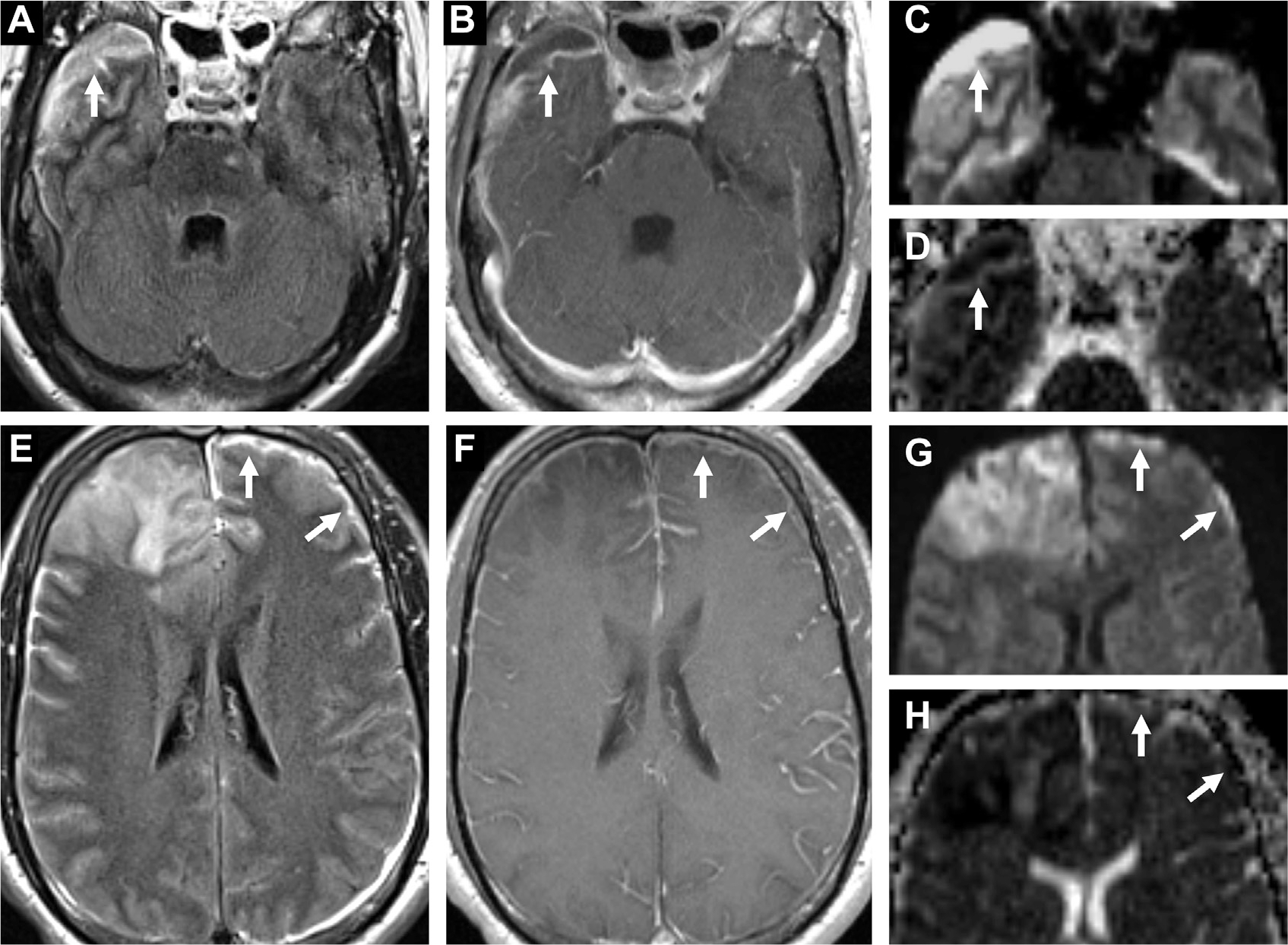 Fig. 22.