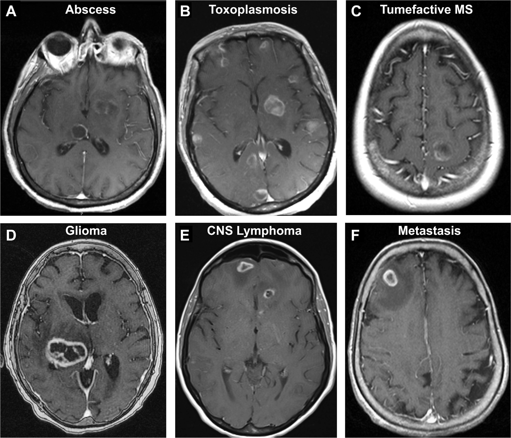 Fig. 29.