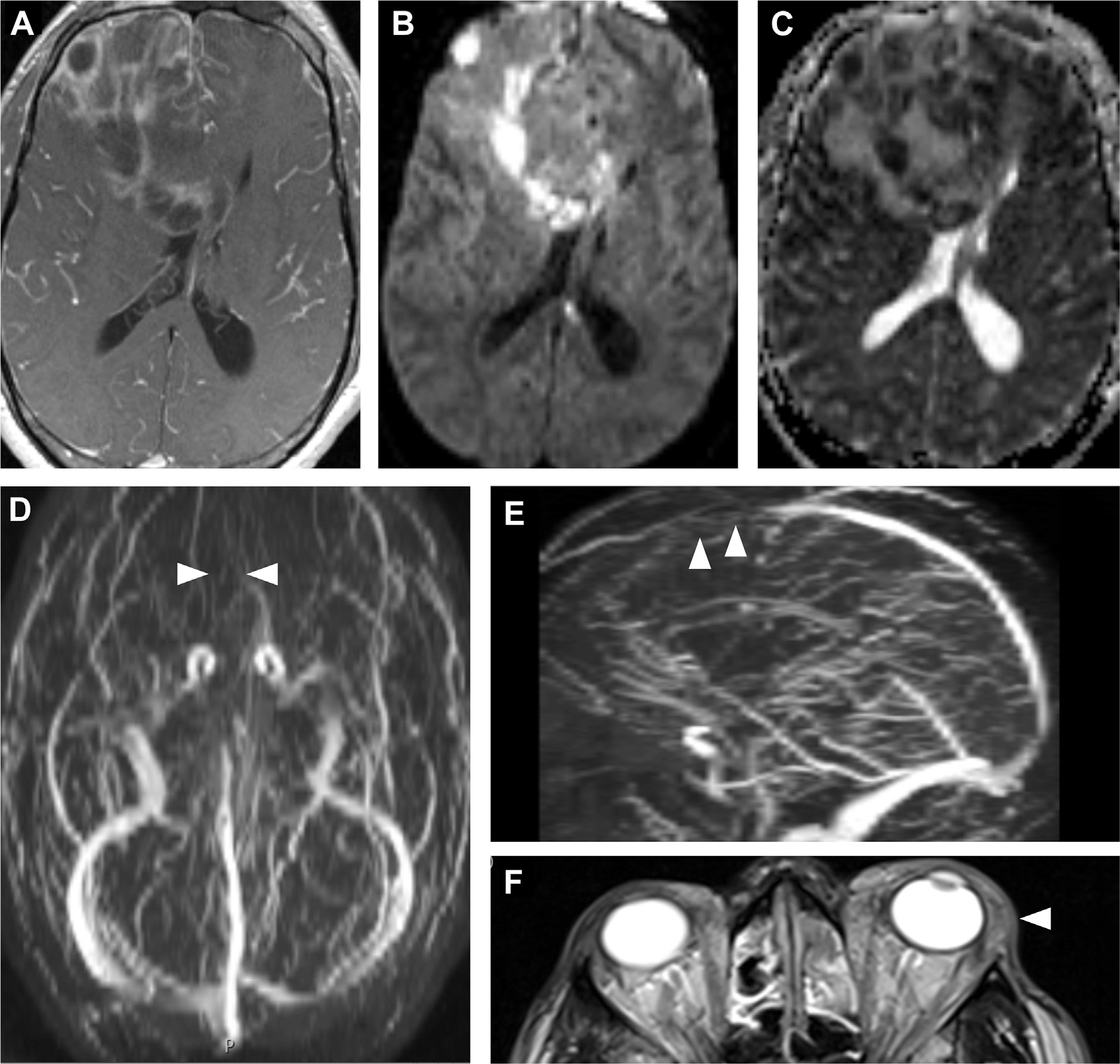 Fig. 25.