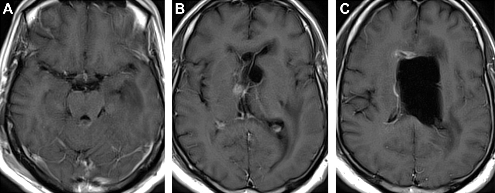 Fig. 21.