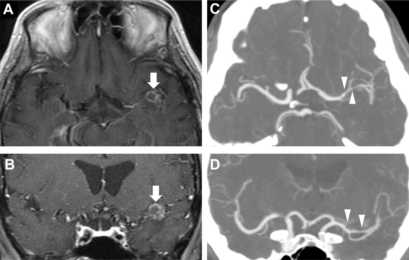 Fig. 26.