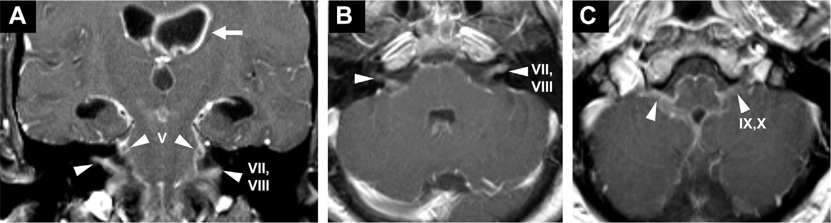 Fig. 24.