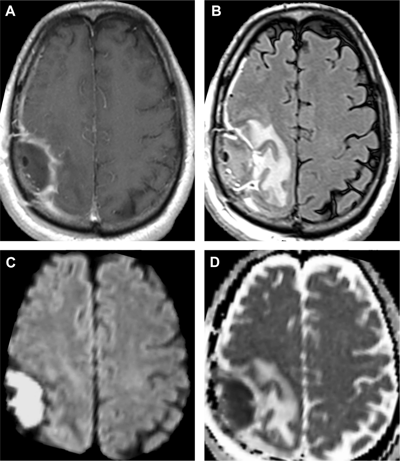 Fig. 23.