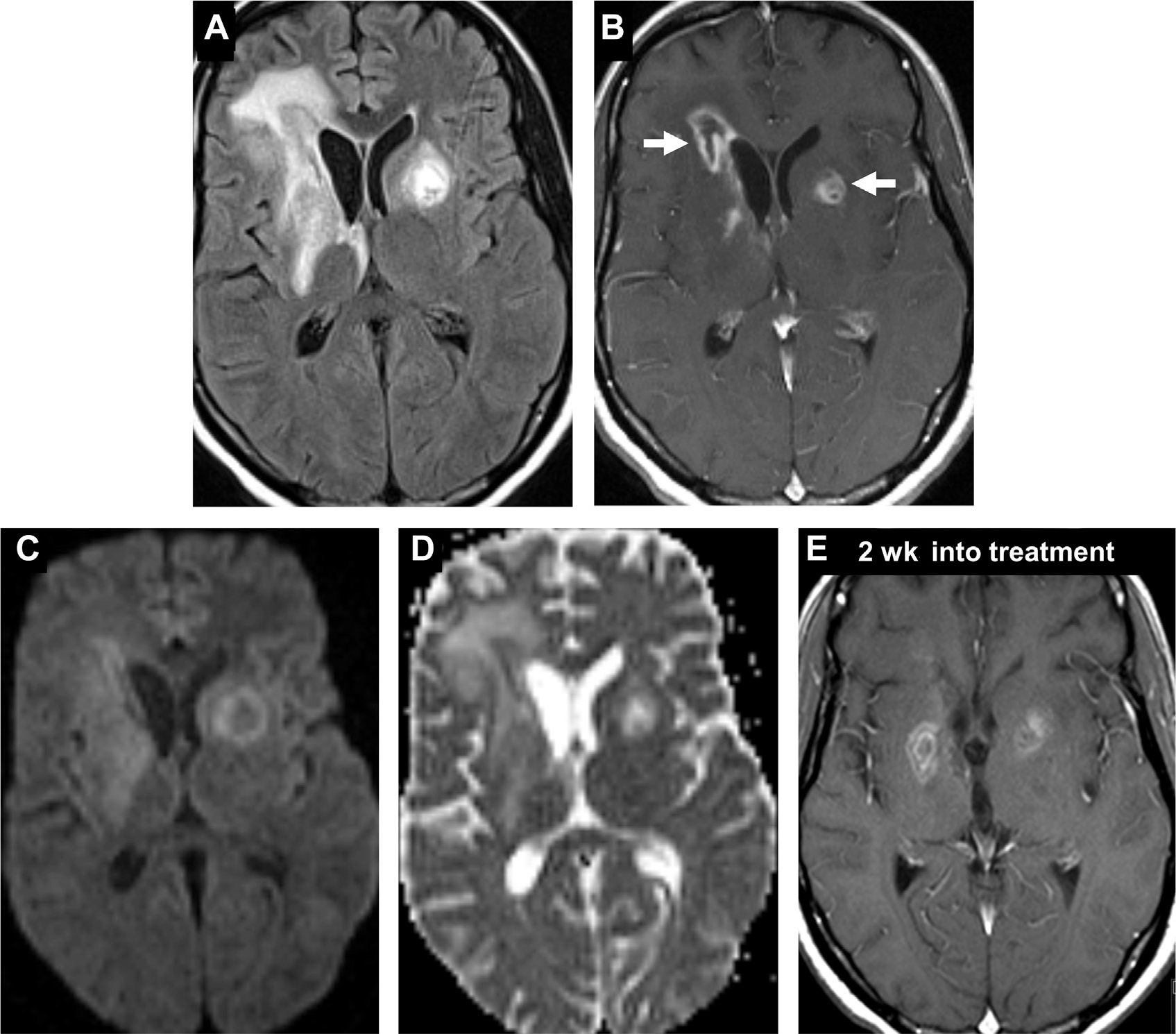 Fig. 16.