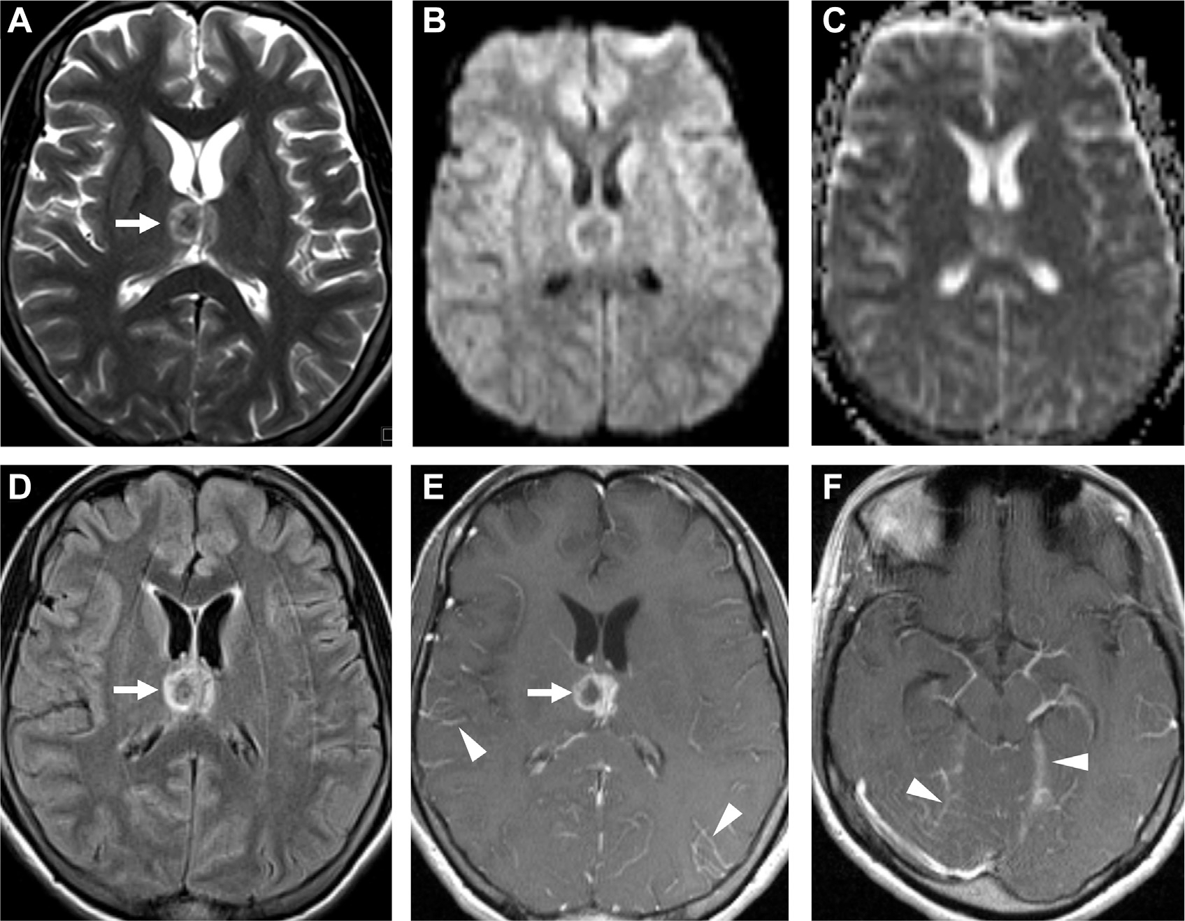 Fig. 17.