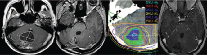 Figure 1: