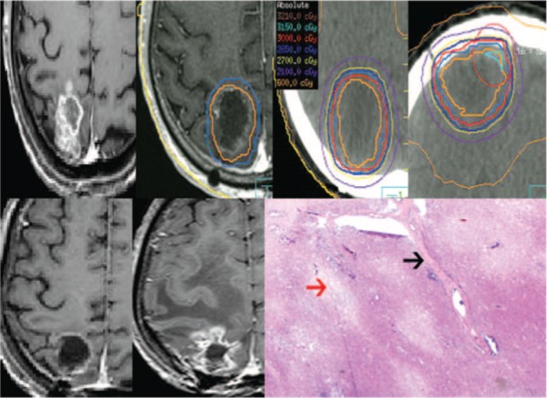 Figure 3: