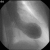 Figure 2b