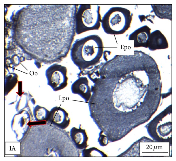 Figure 11