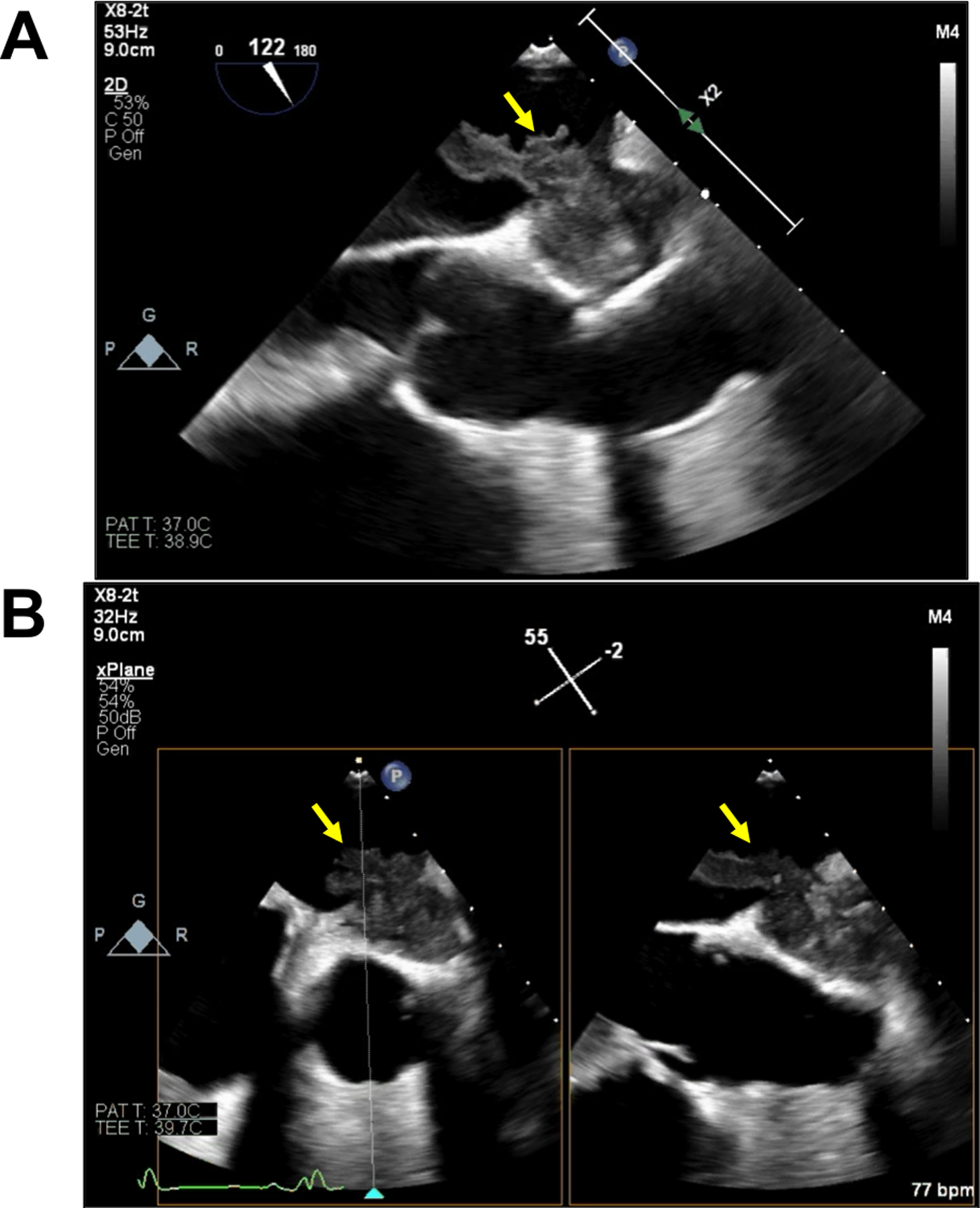 FIGURE 4.