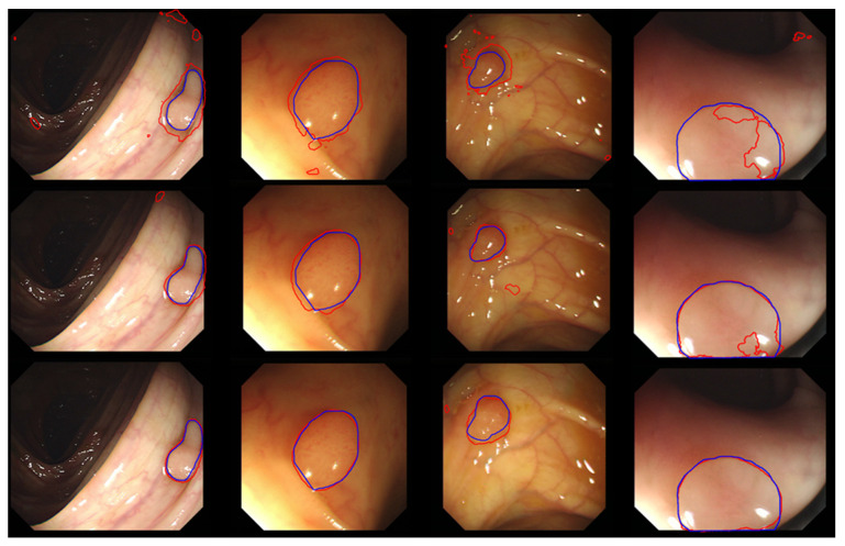 Figure 15