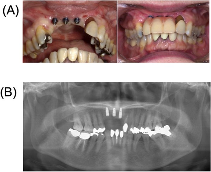 Fig. 6