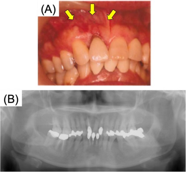 Fig. 1