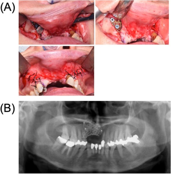 Fig. 4