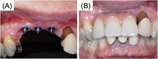 Fig. 7