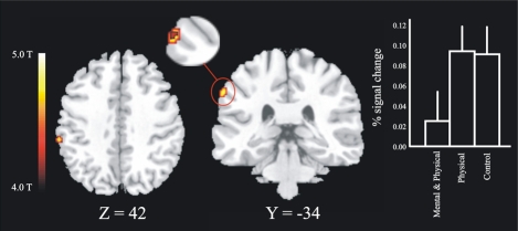 Fig. (4)