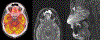 Figure 11: