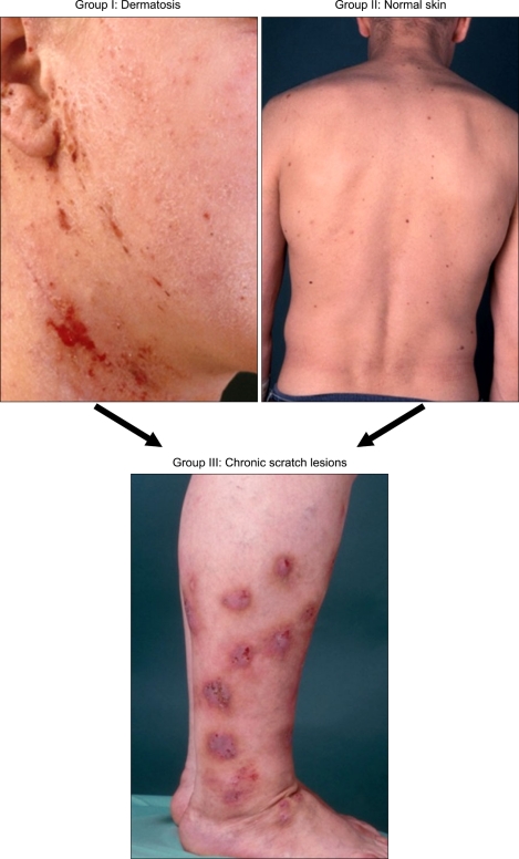 Chronic Pruritus: Clinics and Treatment - PMC