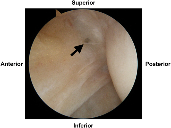 Fig 3