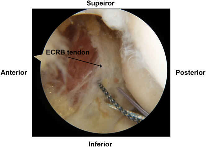 Fig 4