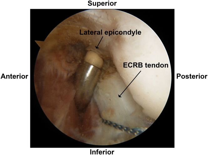 Fig 5