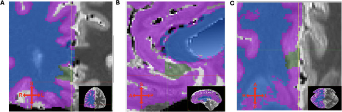 Figure 2