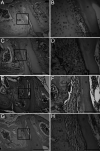 Figure 2. Histological changes after 12 days of force. Close-up view in A (B), in C (D), in E (F), and in G (H). Small arrows indicate TRAP-positive osteoclasts. (A, B) Control group (no force). (C, D) Vehicle-fed, (E, F) LTT-fed, and (G, H) CaCO3-fed mice experimental groups (12 days after orthodontic force). DB indicates distal alveolar bone; LTT, Lithothamnium sp; MB, mesial alveolar bone; PL, periodontal ligament; R, root; TRAP, tartrate-resistant acid phosphatase. Arrow bar = 100 µm.