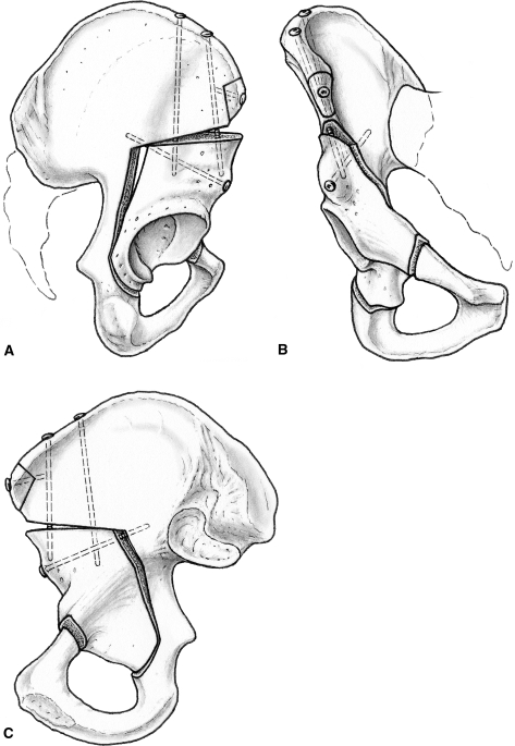 Fig. 1A–C