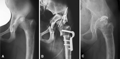 Fig. 6A–C