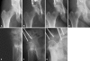Fig. 3A–G
