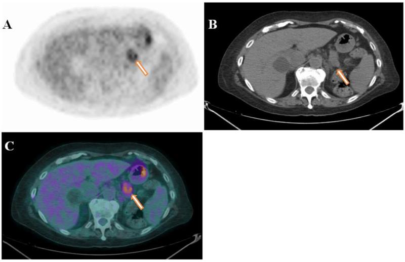 Fig.2