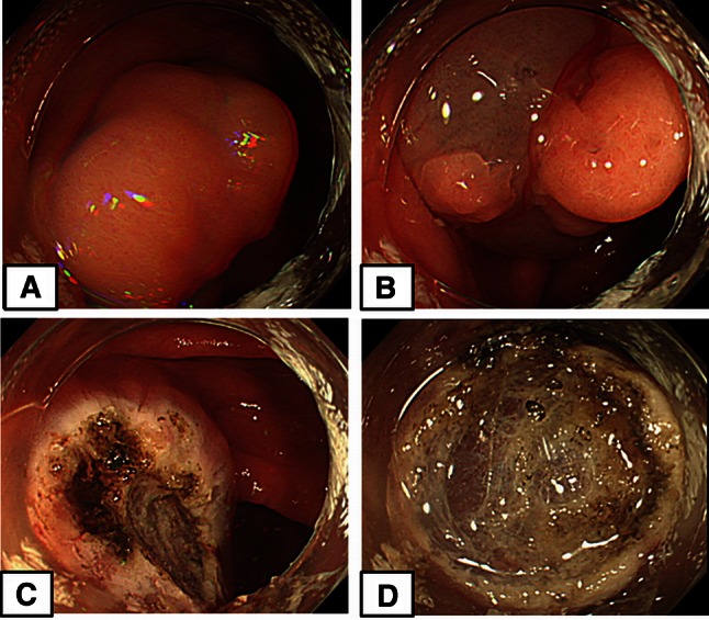 Fig. 2